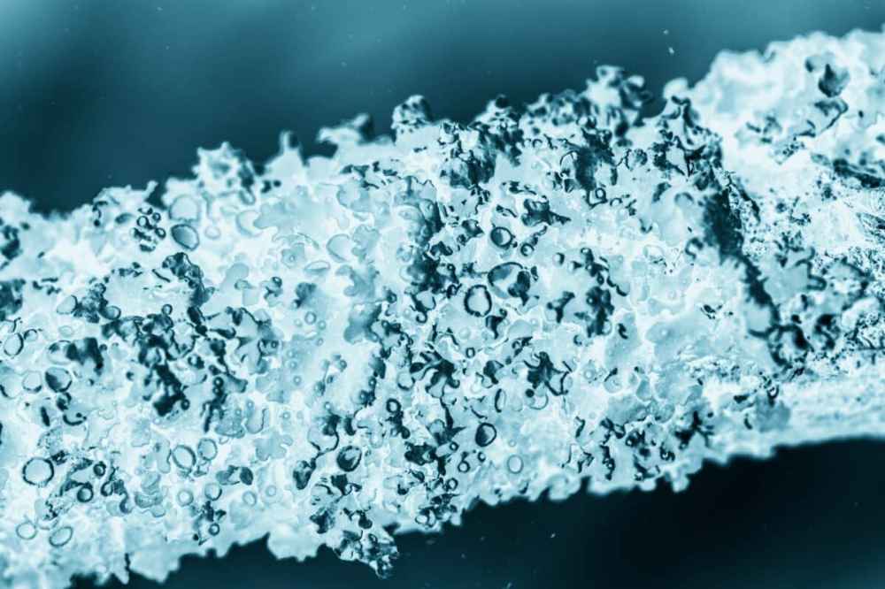 Les bienfaits de l'acide hyaluronique